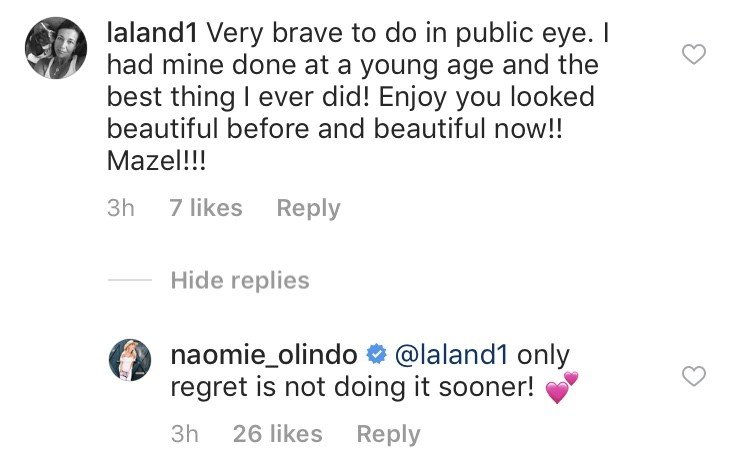 Southern Charm’s Naomi Olindo Admits She Got A Nose Job Southern Charm’s Naomi Olindo Admits She Got A Nose Job